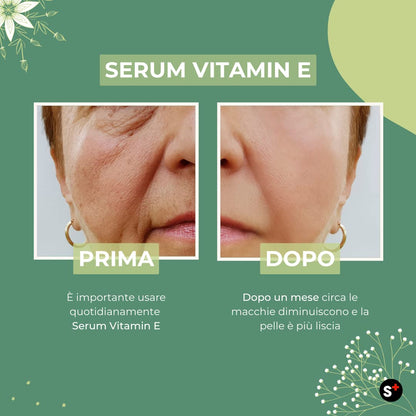 Vitamin serum e